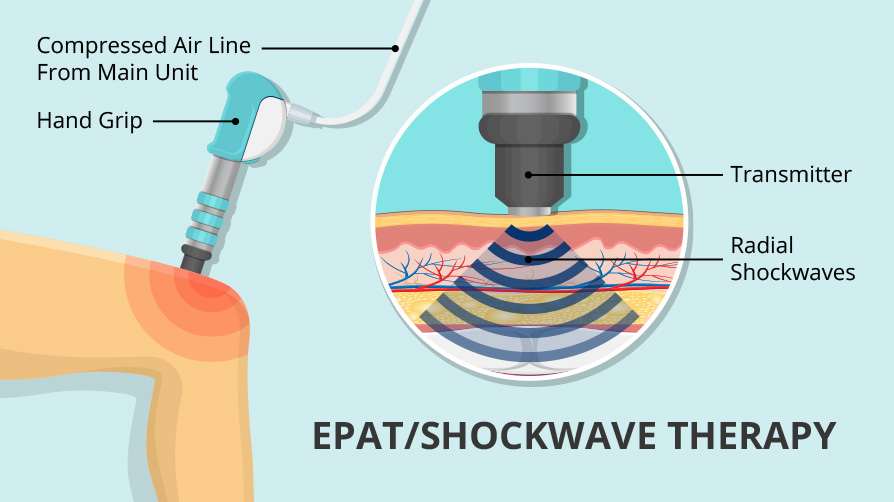 epat-diagram